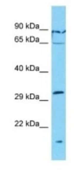 OR7G1 Rabbit anti-Human, Polyclonal, Novus Biologicals:Antibodies:Primary